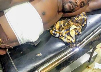 Herbalist Hospitalized After Accidentally Shooting Himself While Testing ‘Bulletproof’ Charm