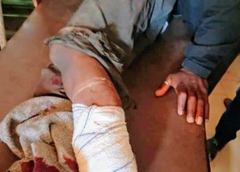 GBY Expresses Sympathy for Bassa Bomb Explosion Victims and Urges Authorities to Combat Terrorism